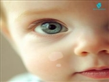 What to know about vitiligo in infants